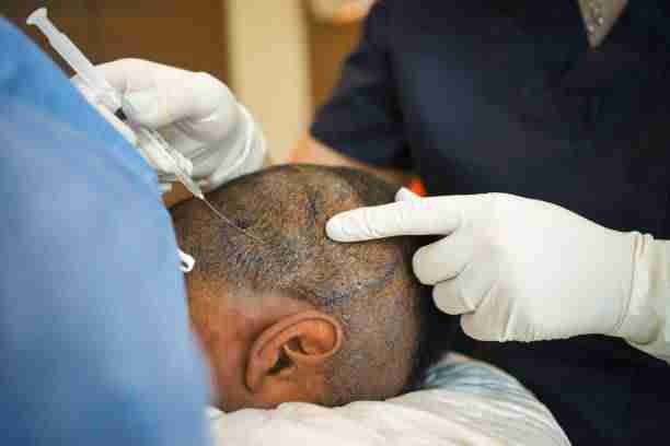 The Mane Makeover: Hair Transplant Tales from Abu Dhabi
