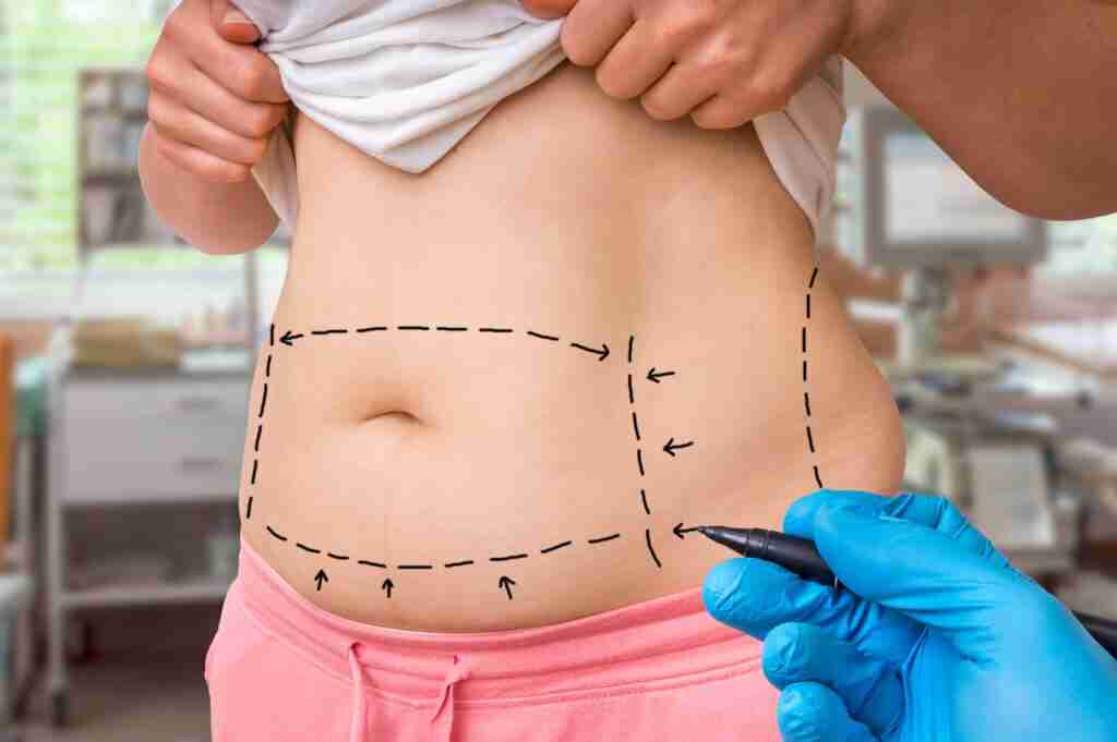 Enhanced Elegance Riyadh’s Best 4D Liposuction Clinic Scene