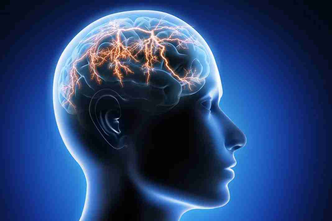 How to Safely Start Taking Pregabalin 100mg for Epilepsy Treatment