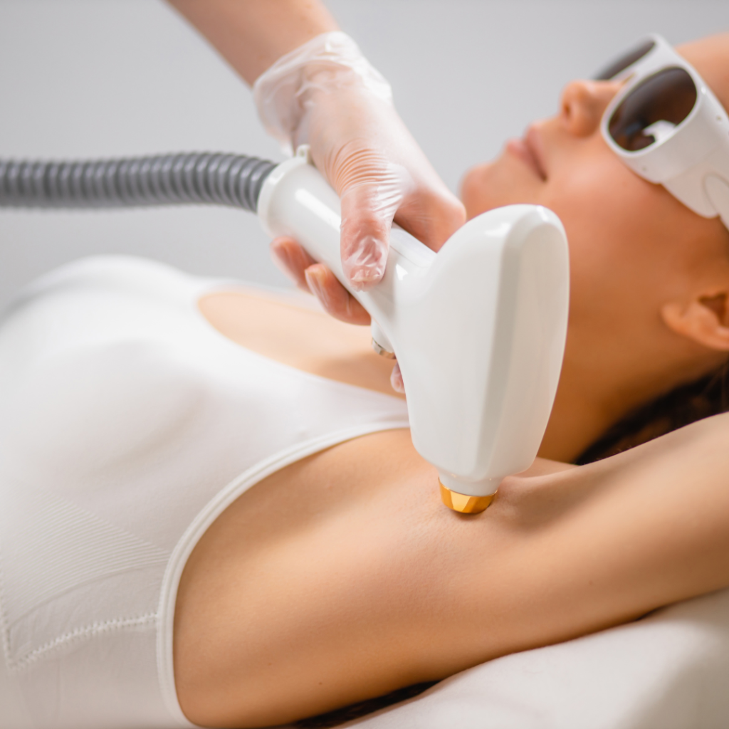 Sleek and Chic Understanding Laser Hair Removal Costs