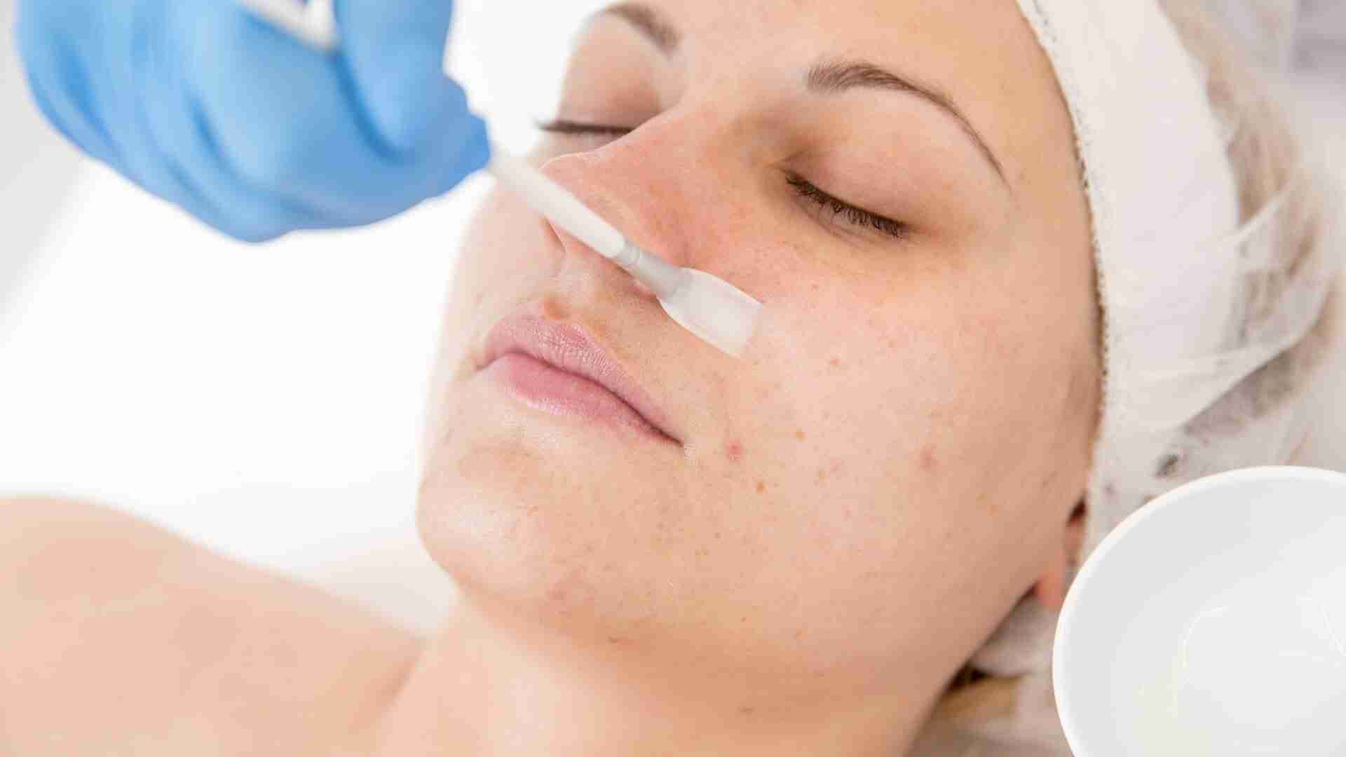 Opulent Opacity Reveling in Riyadh’s Exquisite Chemical Peel Experiences
