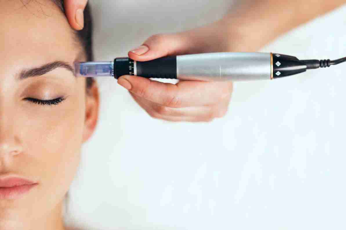 From Dull to Dazzling: How SkinPen Microneedling Is Revolutionizing Skincare