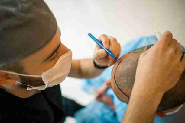 Financial Planning for Hair Transplant Cost in Dubai: Tips and Tricks