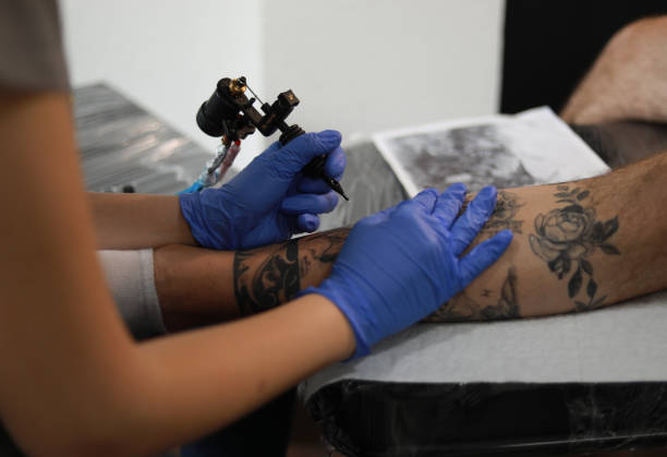 Clean Slate: Tattoo Removal Procedures in Riyadh