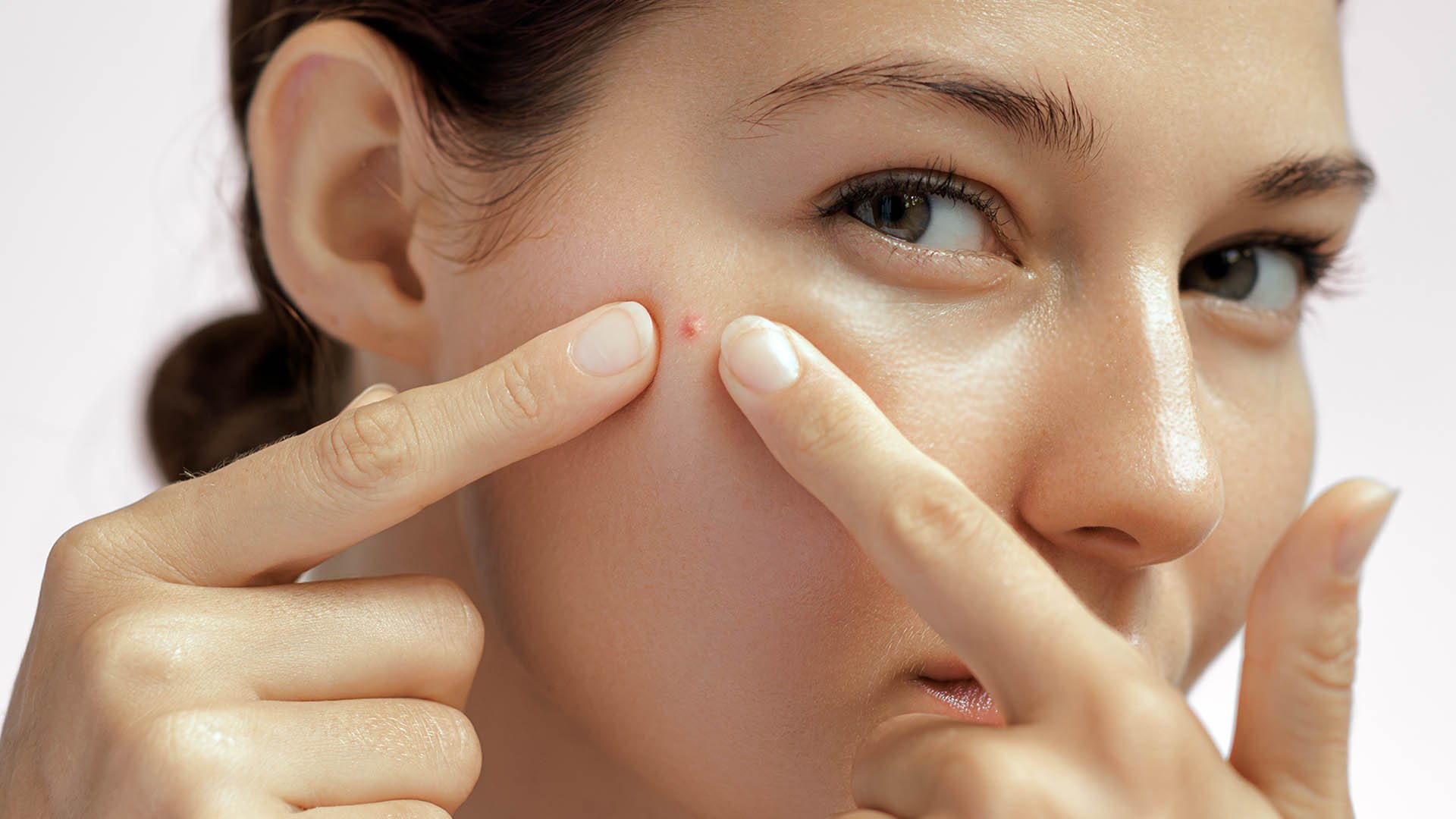 Acne Facial Treatments in Dubai Spas