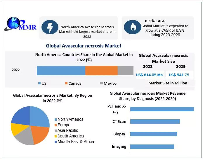 Avascular Necrosis Market Growth: From USD 614.05 Mn in 2022 to USD 941.75 Mn by 2029, Driven by a CAGR of 6.3%