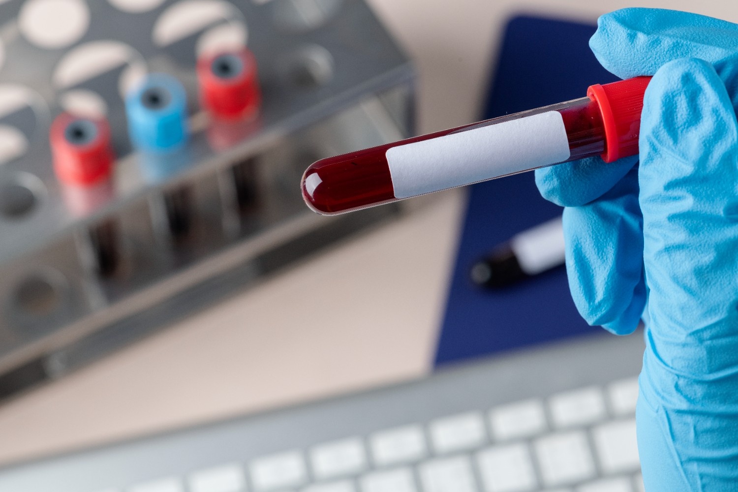 Common Thyroid Issues and How the TSH Blood Test Helps