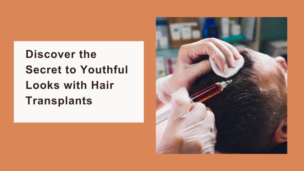 Discover the Secret to Youthful Looks with Hair Transplants