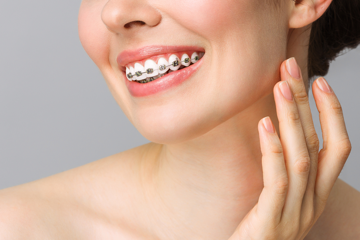The Latest Innovations in Metal Braces: What You Should Know