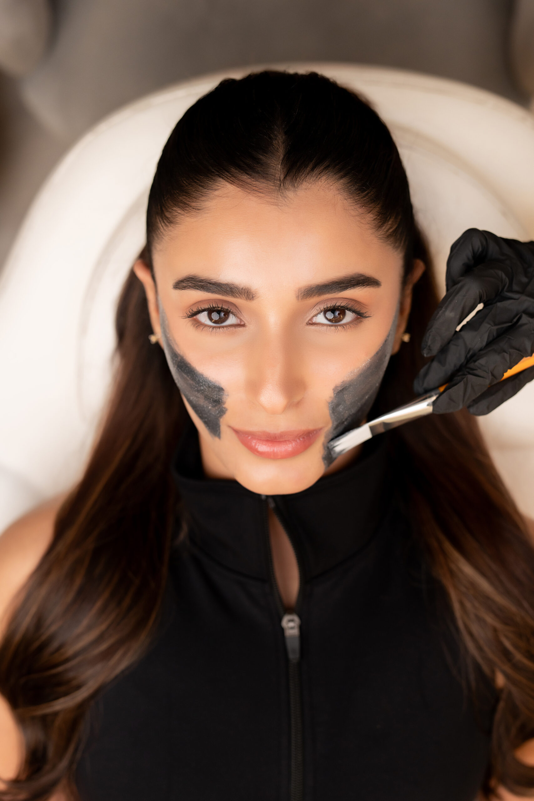 PRP for Acne Scars with 4-Effective Treatment for Clearer Skin
