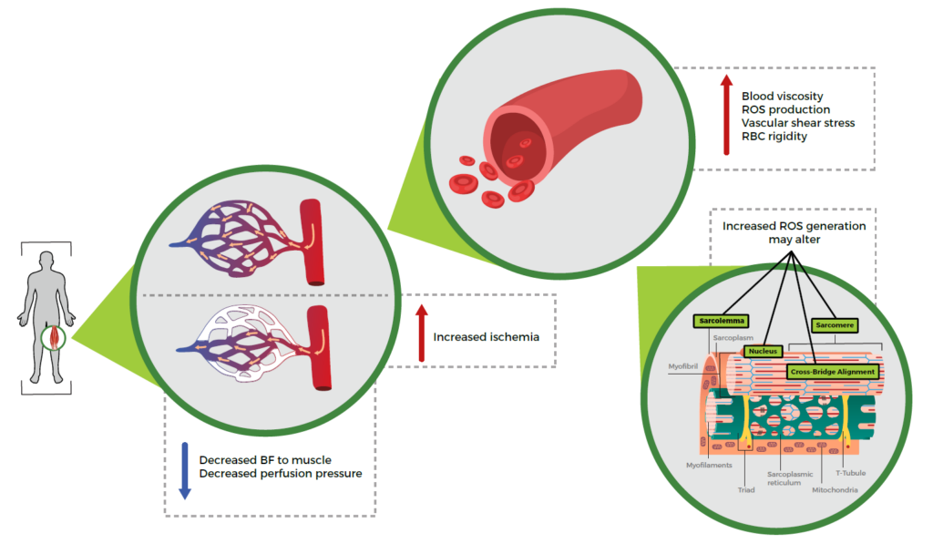 Acute Muscle Spasms Uncovered: The Hidden Role of Dehydration
