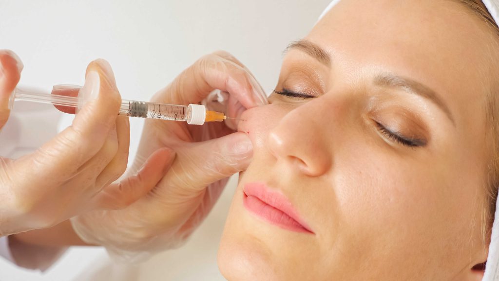 The Benefits and Risks of Cheek Fillers