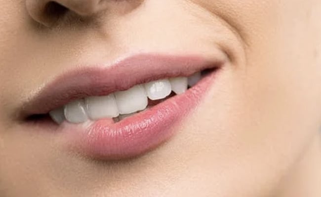 Lip Augmentation: Your Guide to Fuller, Softer Lips
