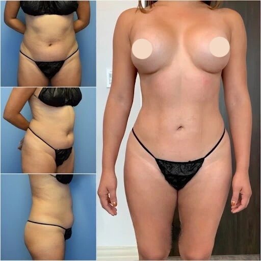 The Benefits of Personalized Treatment Plans with the Best Body Contouring Surgeons in dubai