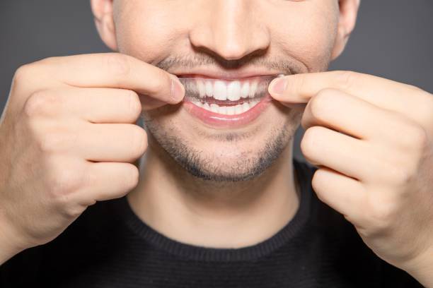 How to Choose the Best Teeth Whitening Strips in Riyadh