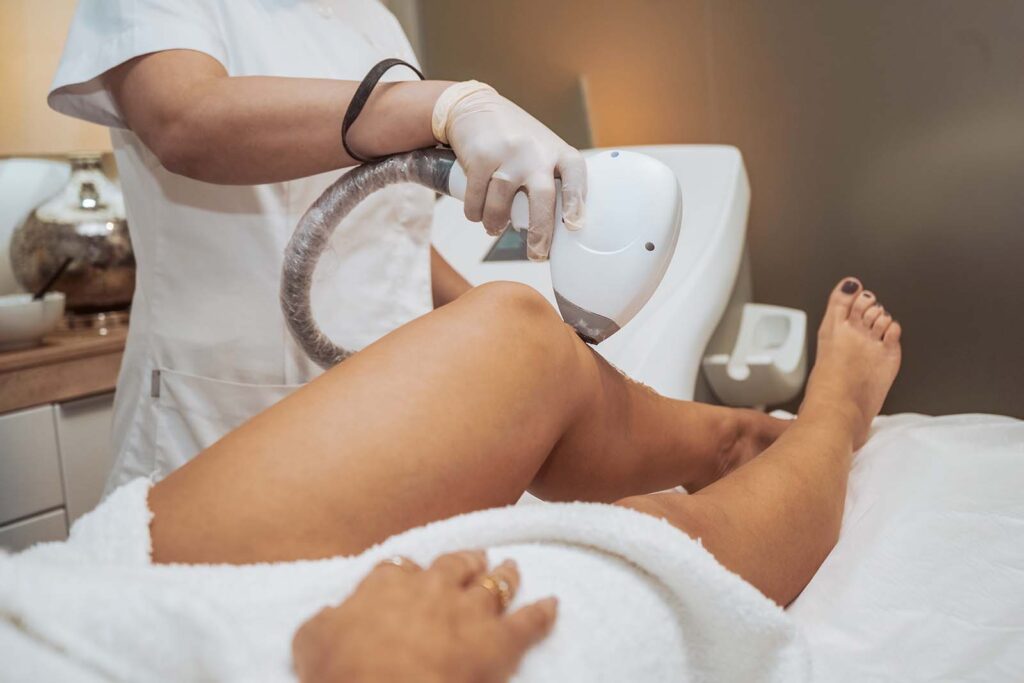 The Best Candidates for Laser Liposuction