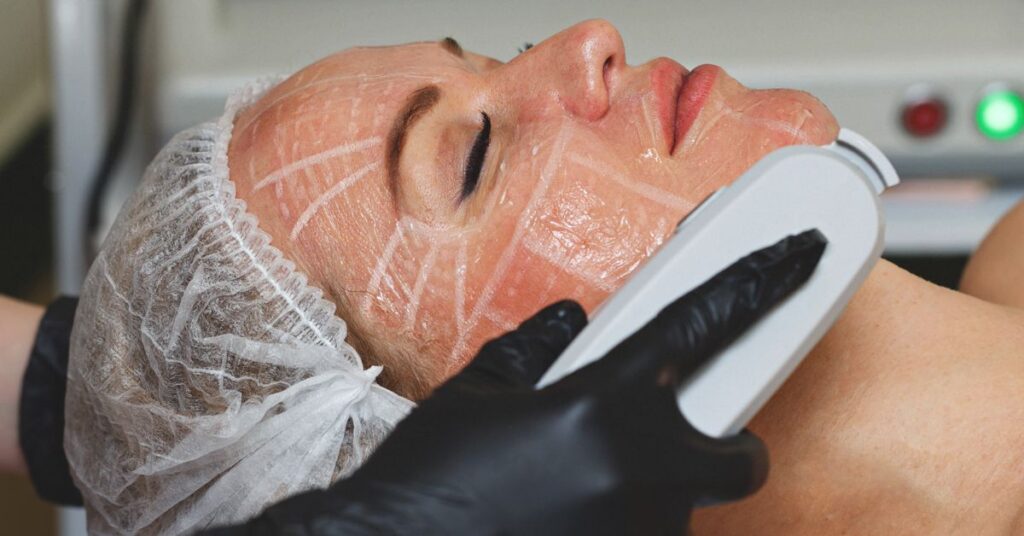 Why Laser Skin Tightening is the Best Anti-Aging Solution