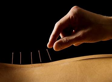 How Acupuncture Regulates Menstrual Cycles for Fertility: Benefits, Science, and Insights