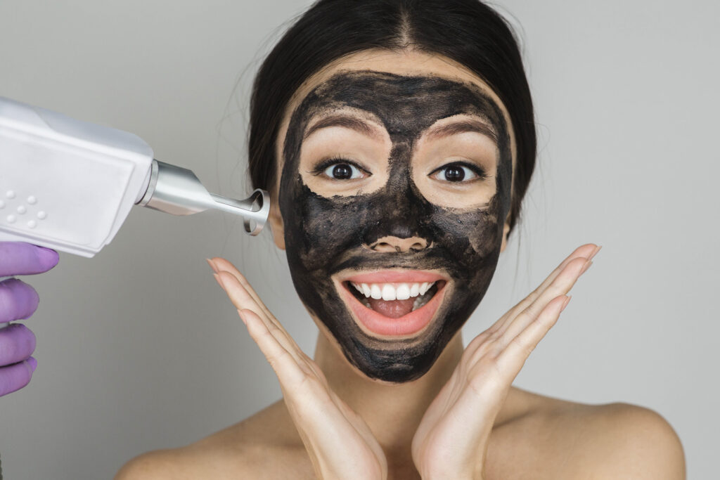 Laser Carbon Peel A Revolutionary Skin Treatment