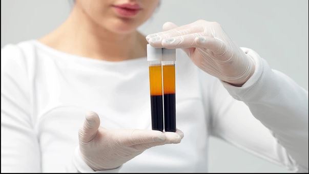 India Plasma Fractionation Market Size, Growth & Trends Report 2025-2033