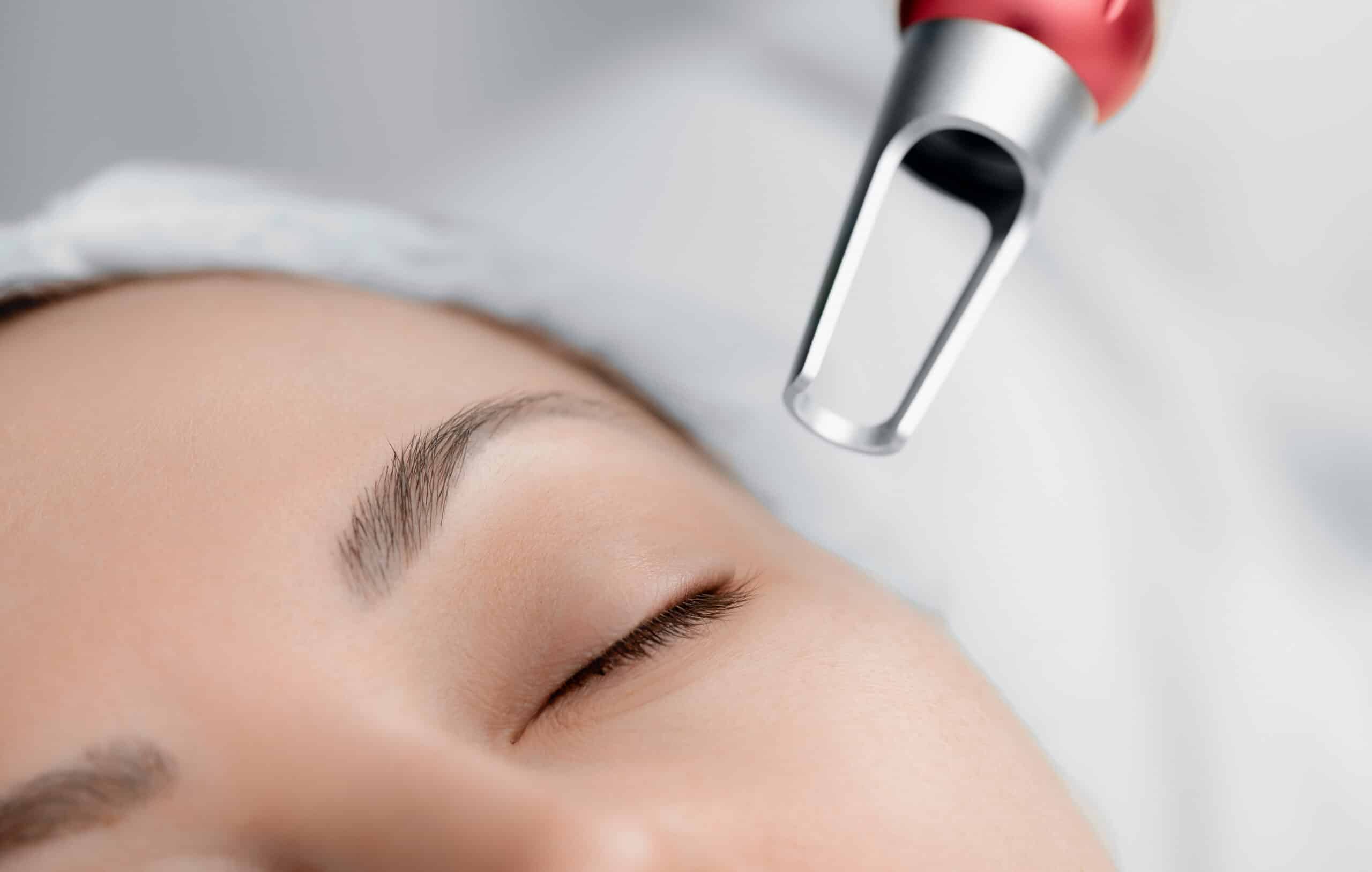Post-Treatment Care for Laser Skin Resurfacing