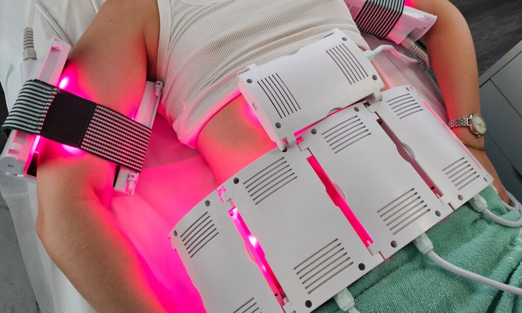 What to Expect from Laser Lipolysis Treatment