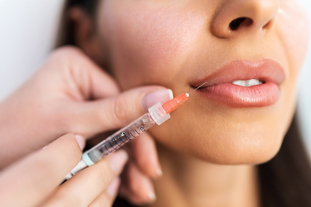 Why You Should Choose Volift Fillers
