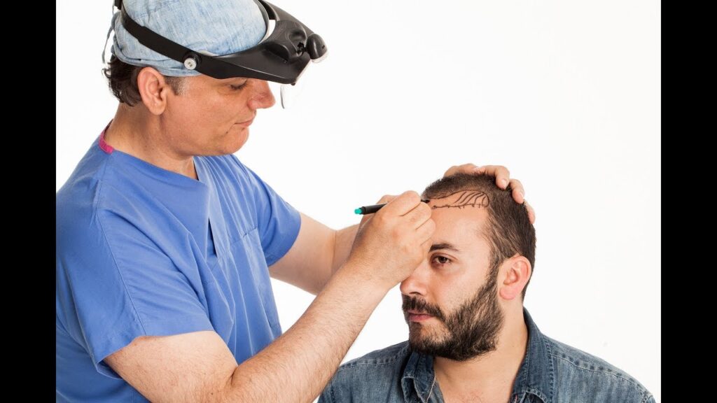 Hair Restoration in Regina: Unlocking Solutions for Thinning Hair and Baldness
