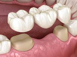 Why You Need the Best Emergency Pediatric Dentist in Billings, MT?