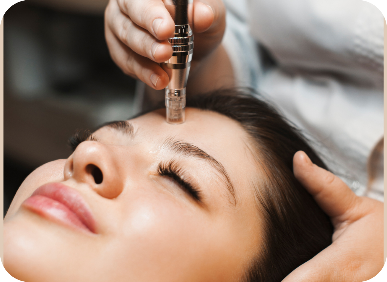Skin Needling Buranda: Revitalize Your Skin Naturally