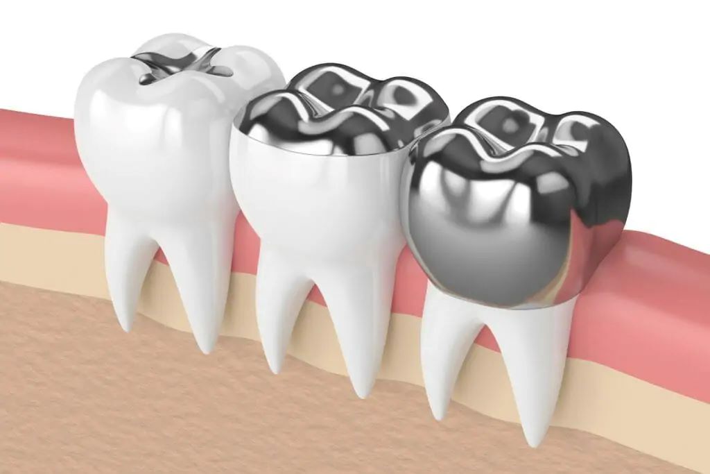 Restorative Dentistry in Nampa, ID: A Complete Guide to a Healthy Smile