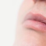 Benefits of Russian Lip Fillers Over Traditional Methods