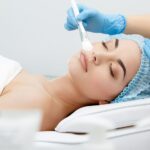 Where Can You Get the Best Chemical Peel Results?