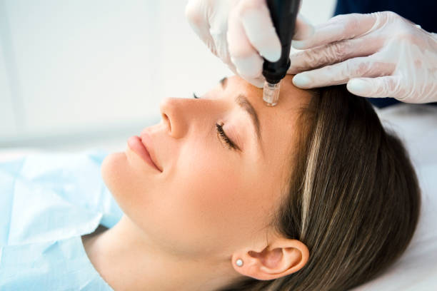 Derma Pen: The Secret to Glowing Skin