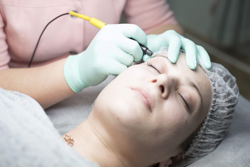 Electrolysis Hair Removal: The Ultimate Solution for Ingrowns