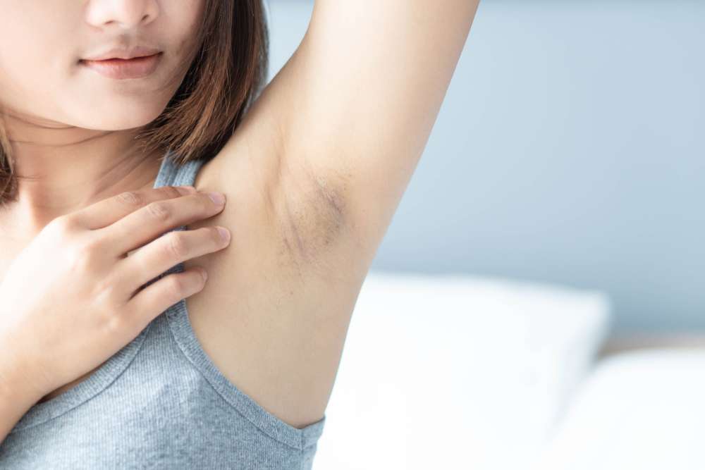 How Weather Affects Armpit Whitening Treatment Results