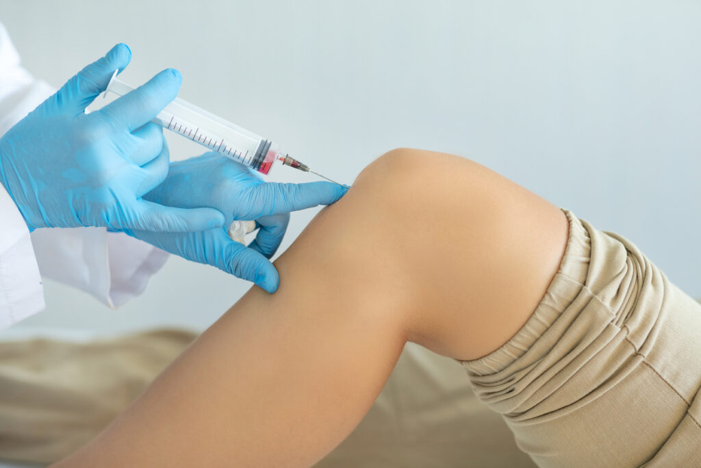 PRP Injections for Runner’s Knee