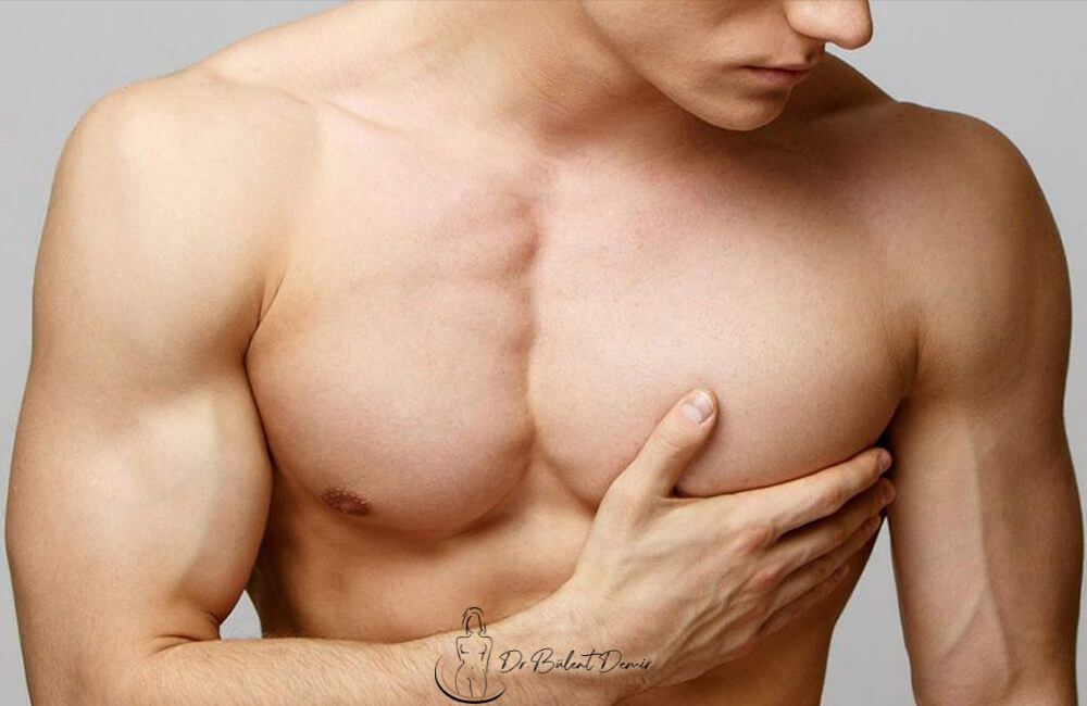 Recovering from Gynecomastia Surgery