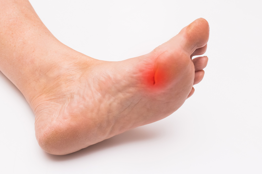 What Are the Causes of Cut and Puncture Wounds?