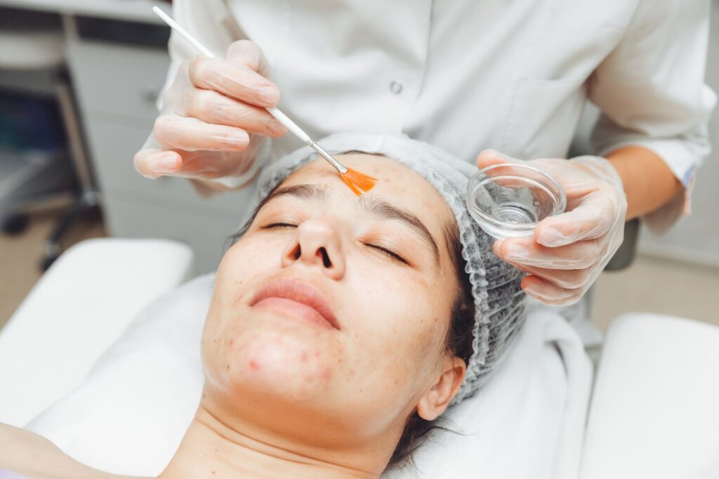 Is Cold Peel Right for You?