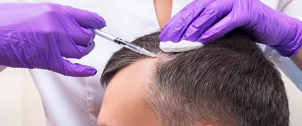 Common Front Line Hair Fixing Mistakes