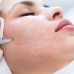 Where Skin Whitening Injection Shines for Skin