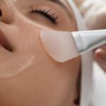 Superficial Chemical Peels and Exfoliation