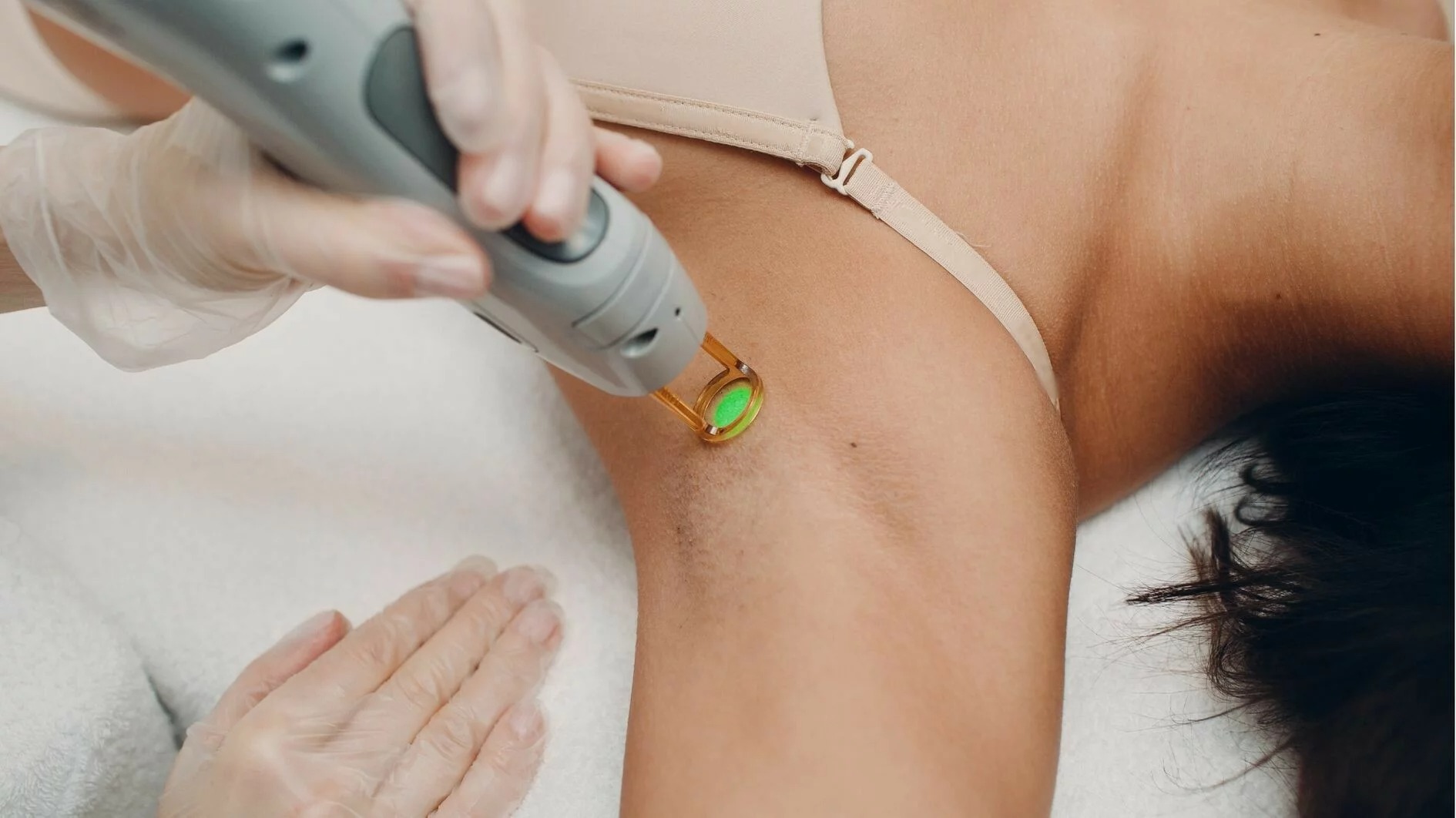 Electrolysis Laser Hair Removal in Dubai