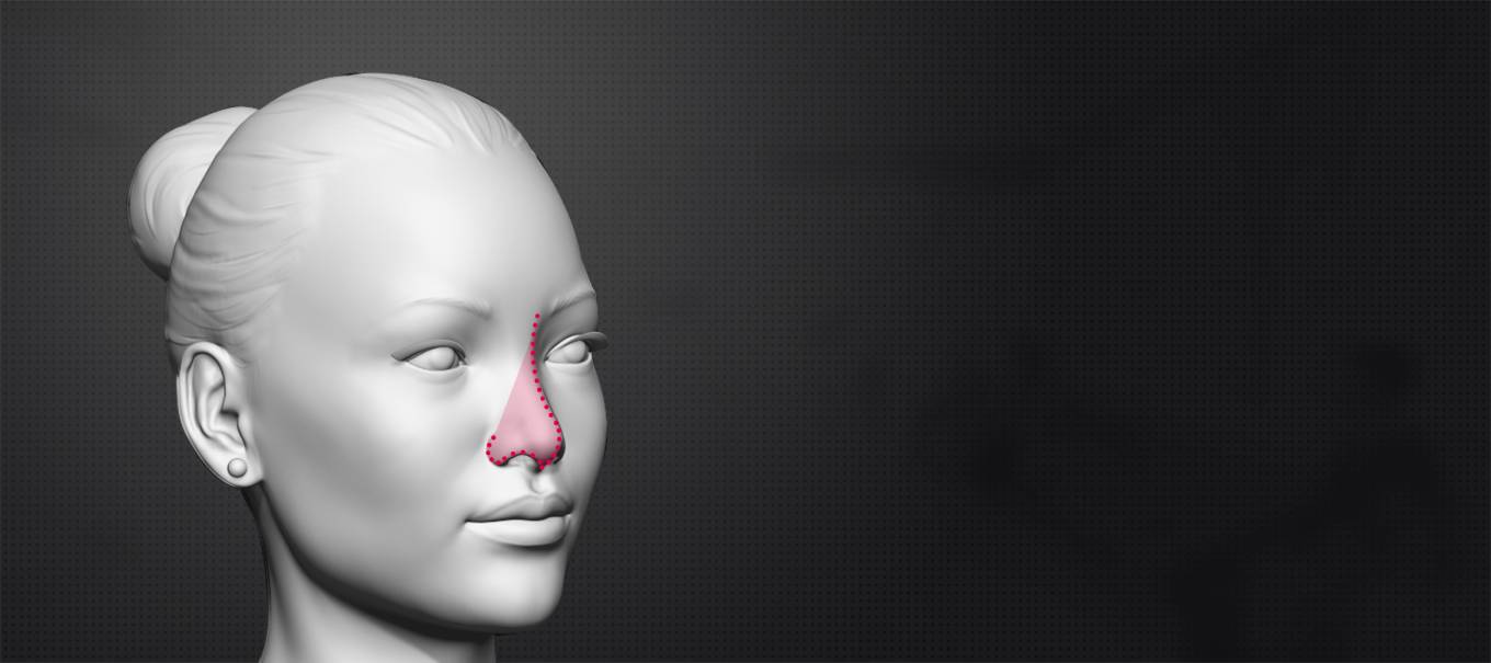 Common Fears About Facial Feminization Surgery
