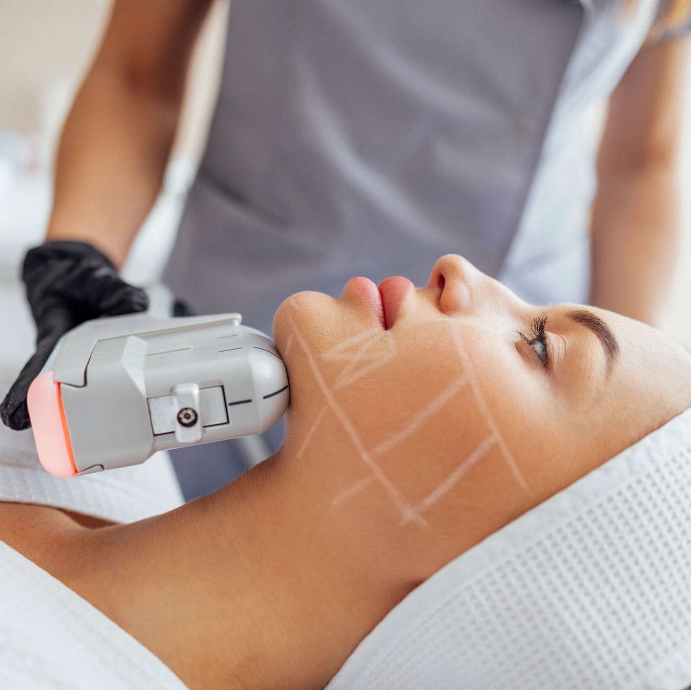 Your Youth The Revolution of 7D HIFU Facial Treatment