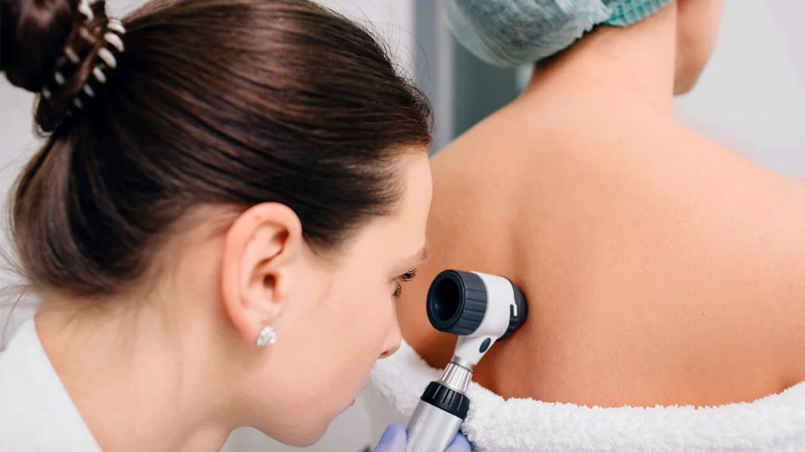 Best Dermatologist in Dubai