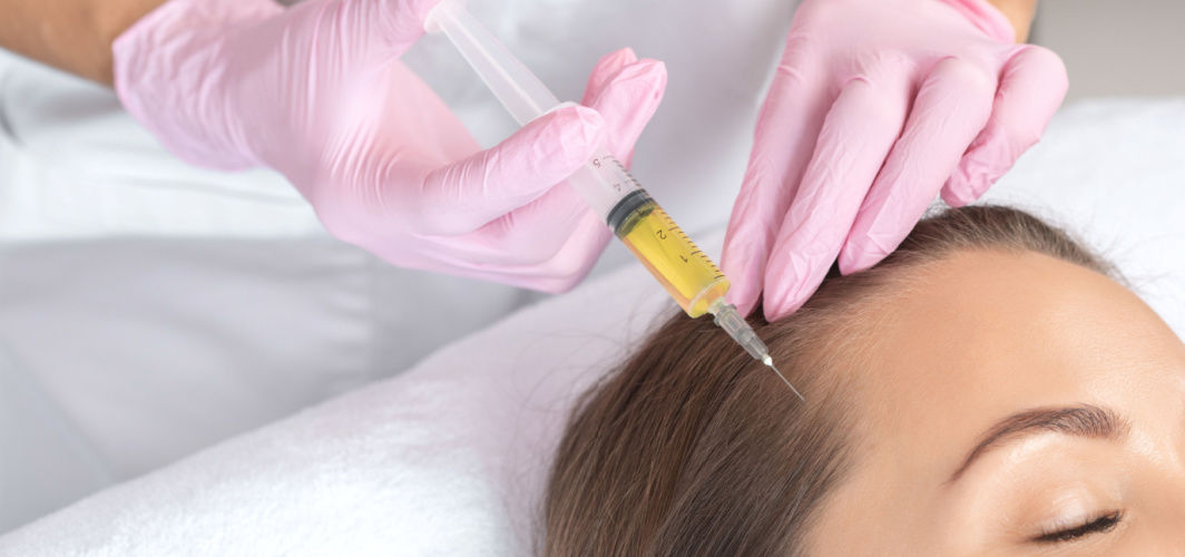 Best PRP Hair Treatment in Dubai