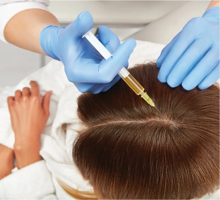 Best PRP Hair Treatment in Dubai