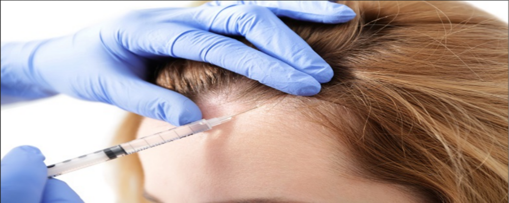 How Does Prp Stimulate Hair Growth?